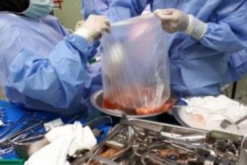 اعضای بدن بازیکن استقلال به ۵ بیمار حیات بخشید.