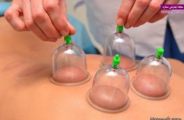 چه کسانی اصلا حجامت نکنند؟!